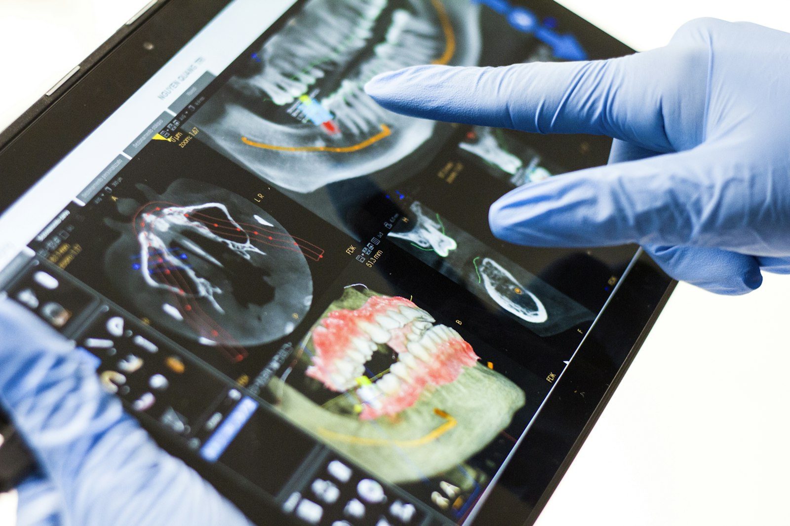A clinician reviewing a 3D dental scan on a tablet
